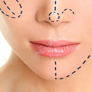 Get a Chiseled Face With Facial Liposuction